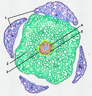 cross-section Lycopodium stem